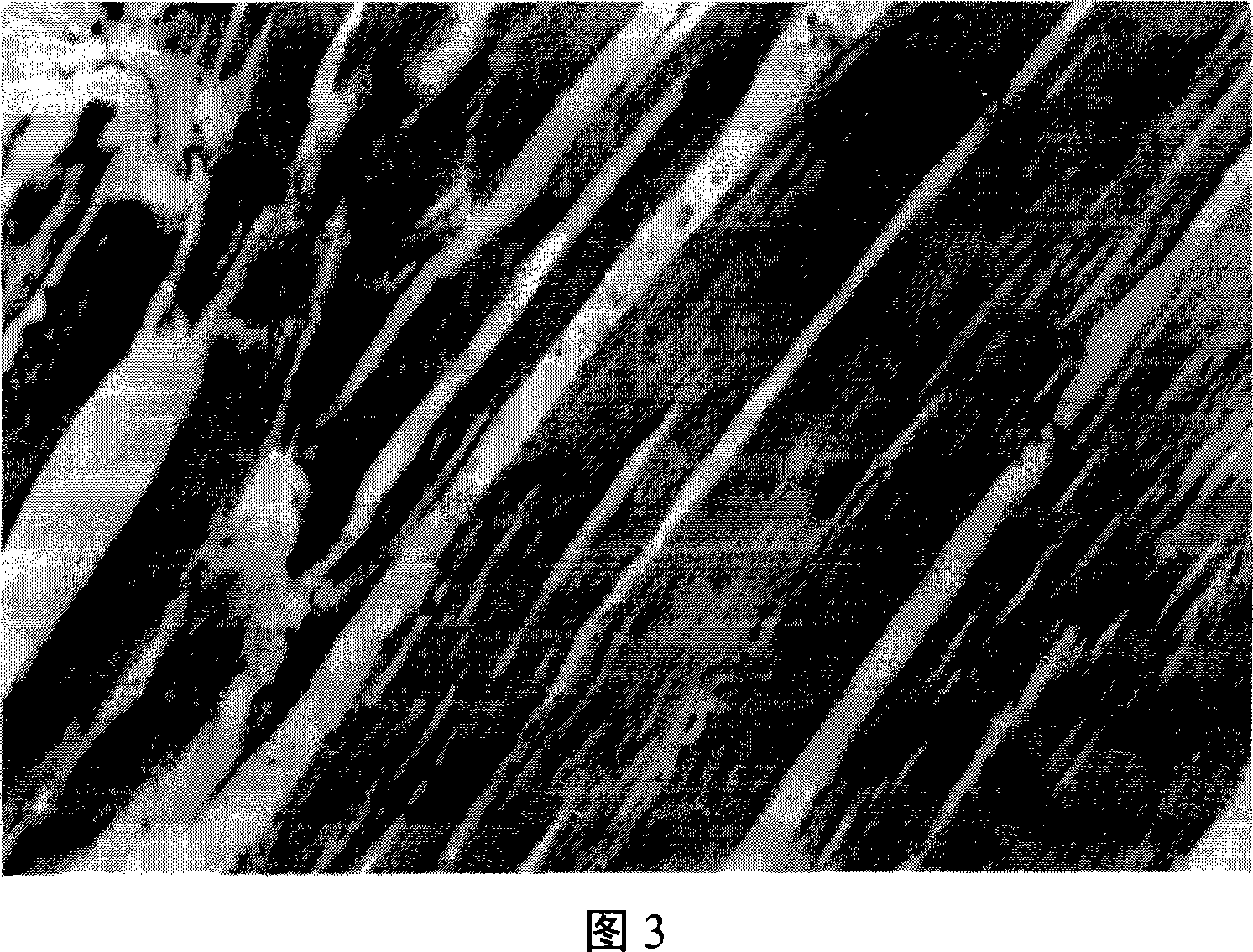 'Yanhuning' frozen-dried powder injection and its preparation method