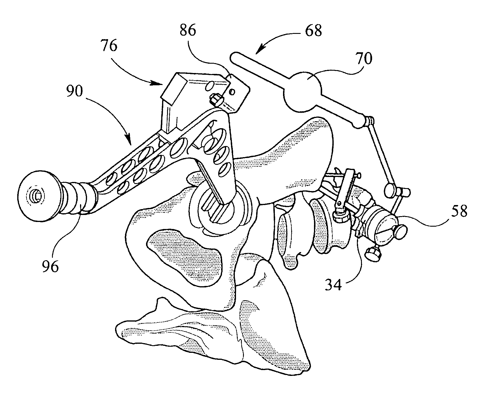 Alignment device