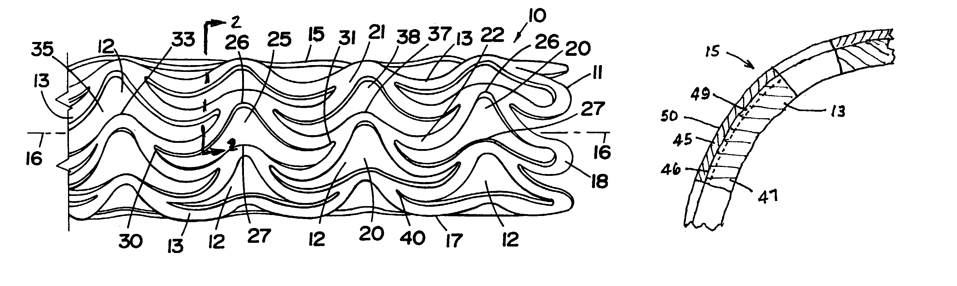 Metal stent with surface layer of noble metal oxide and method of fabrication