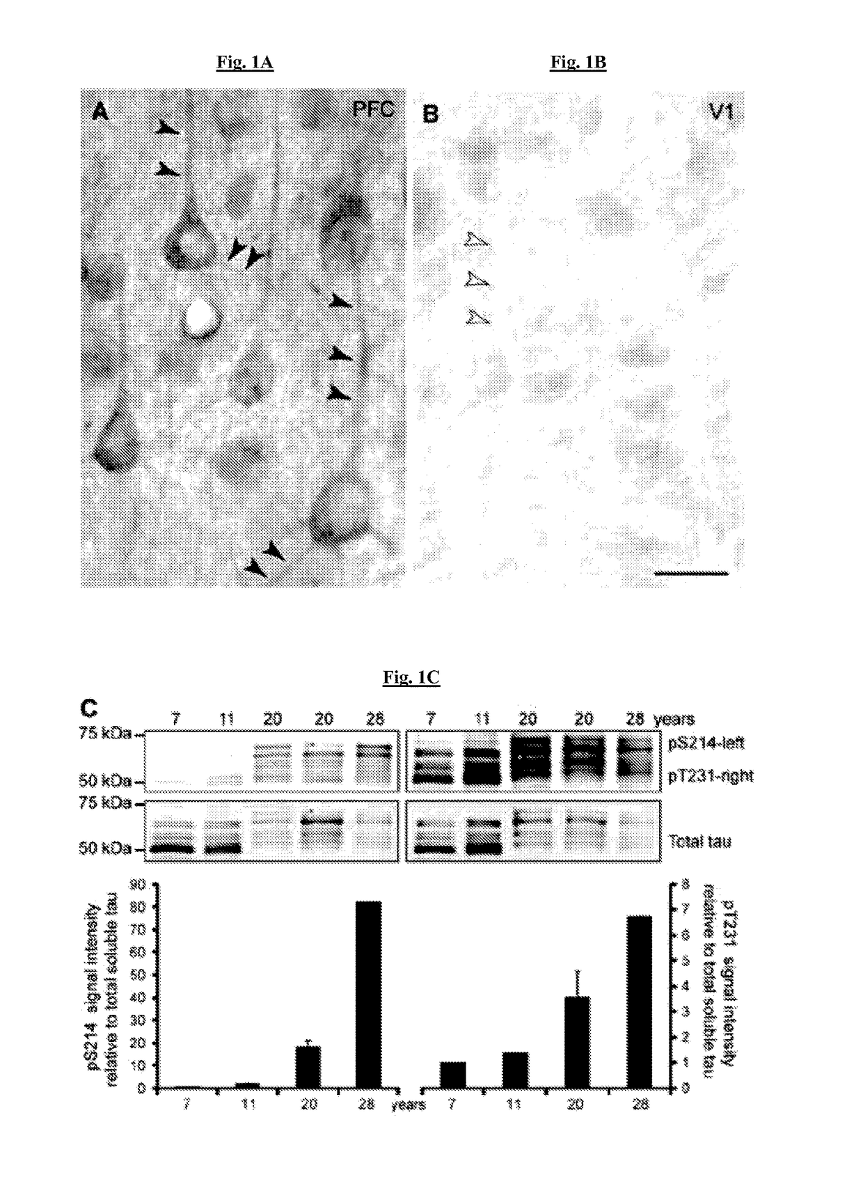 Methods of preventing neurodegeneration of association cortex in a mammal