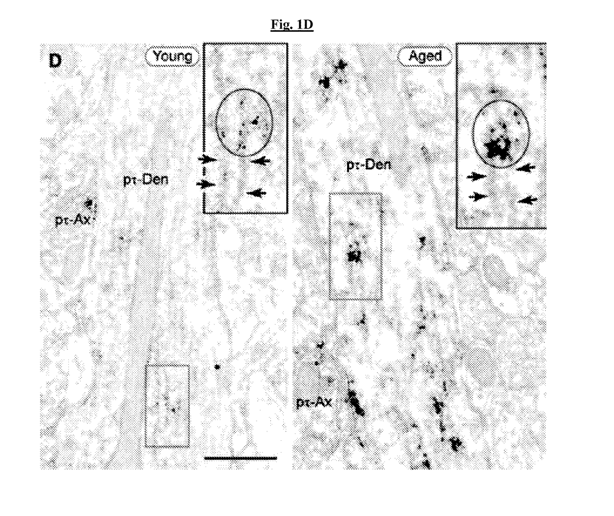 Methods of preventing neurodegeneration of association cortex in a mammal