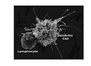 Preparation method of dendritic cell (DC) vaccine loaded with autologous tumor associated holoantigen