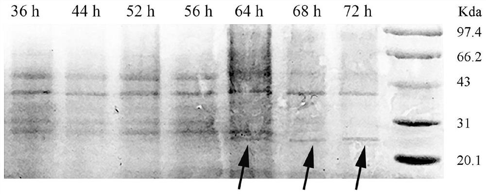 A kind of bovine lactoferrin peptide-human lysozyme fusion protein, gene and application thereof