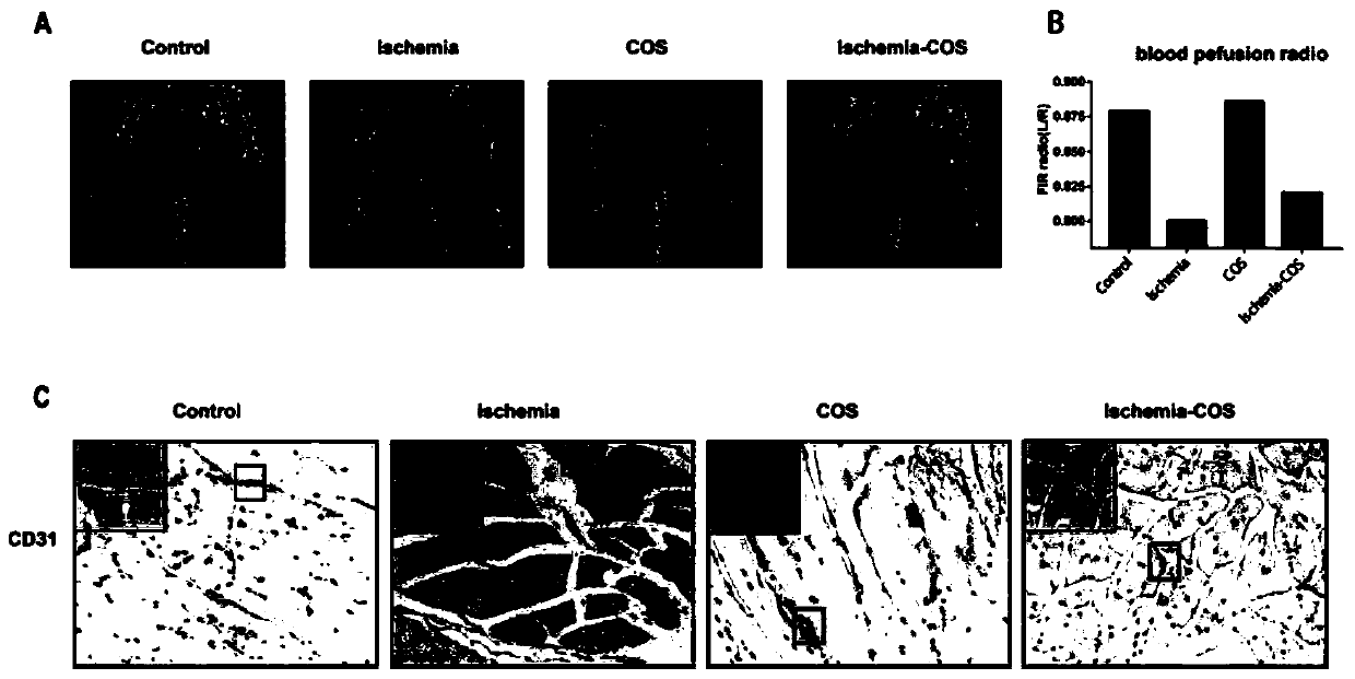 Application of chitosan oligosaccharide in improving lower limb ischemia caused by various diseases