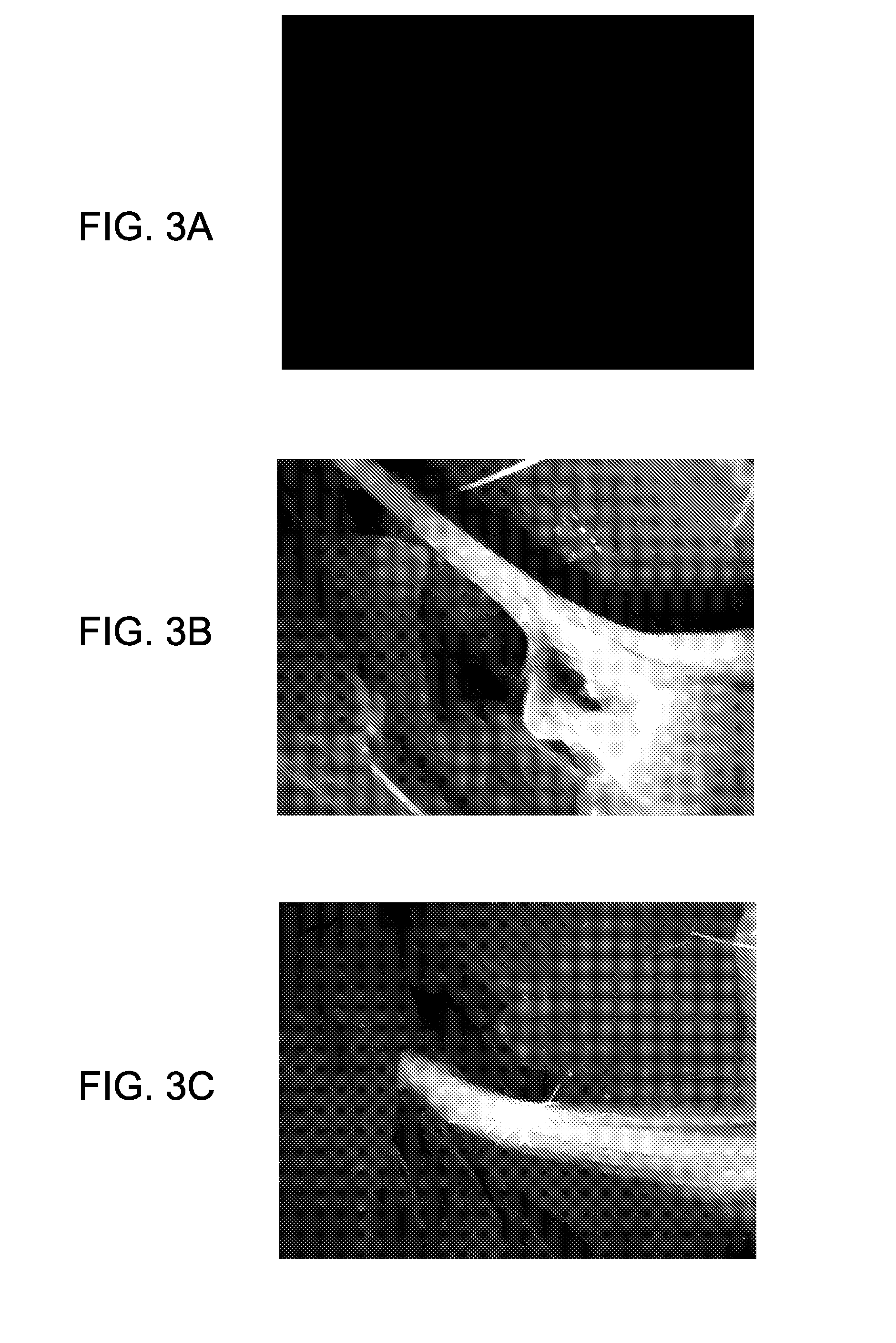 Methods of detecting myelin basic protein