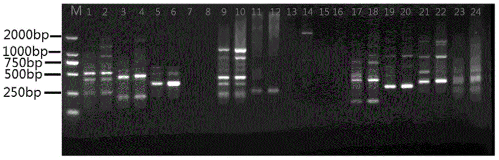 ISSR(Inter-simple Sequence Repeat)-PCR(Polymerase Chain Reaction) molecular marker method for macromitrium gymnostomum