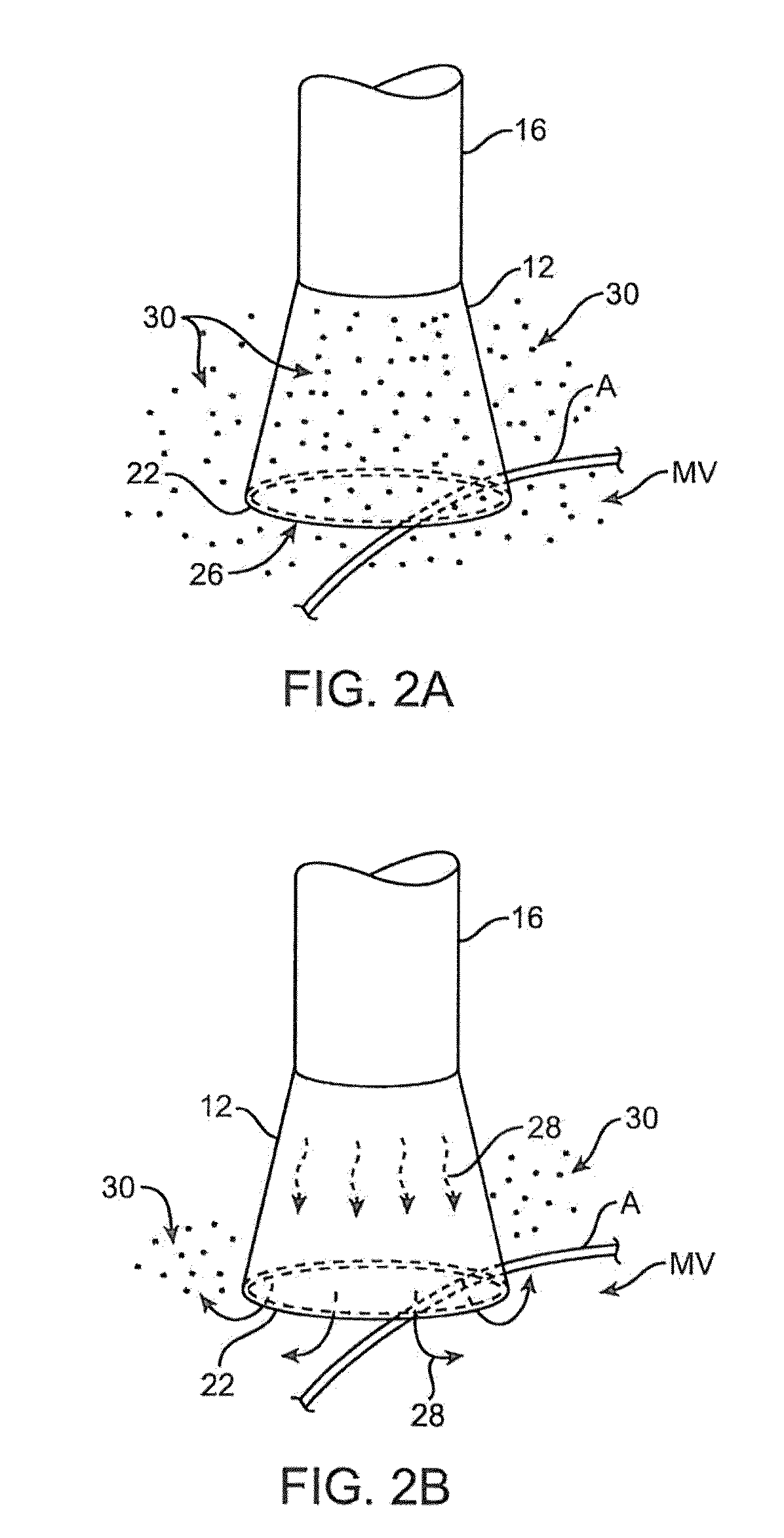 Catheter orientation control system mechanisms