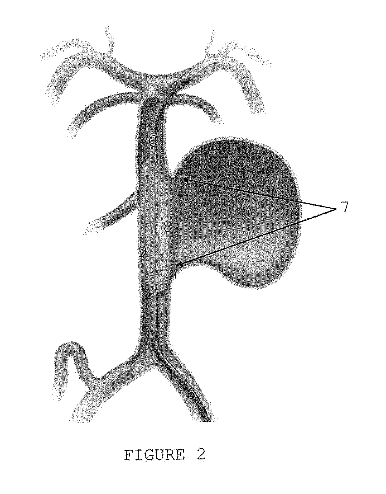 Medical applications of a miniature videoscope