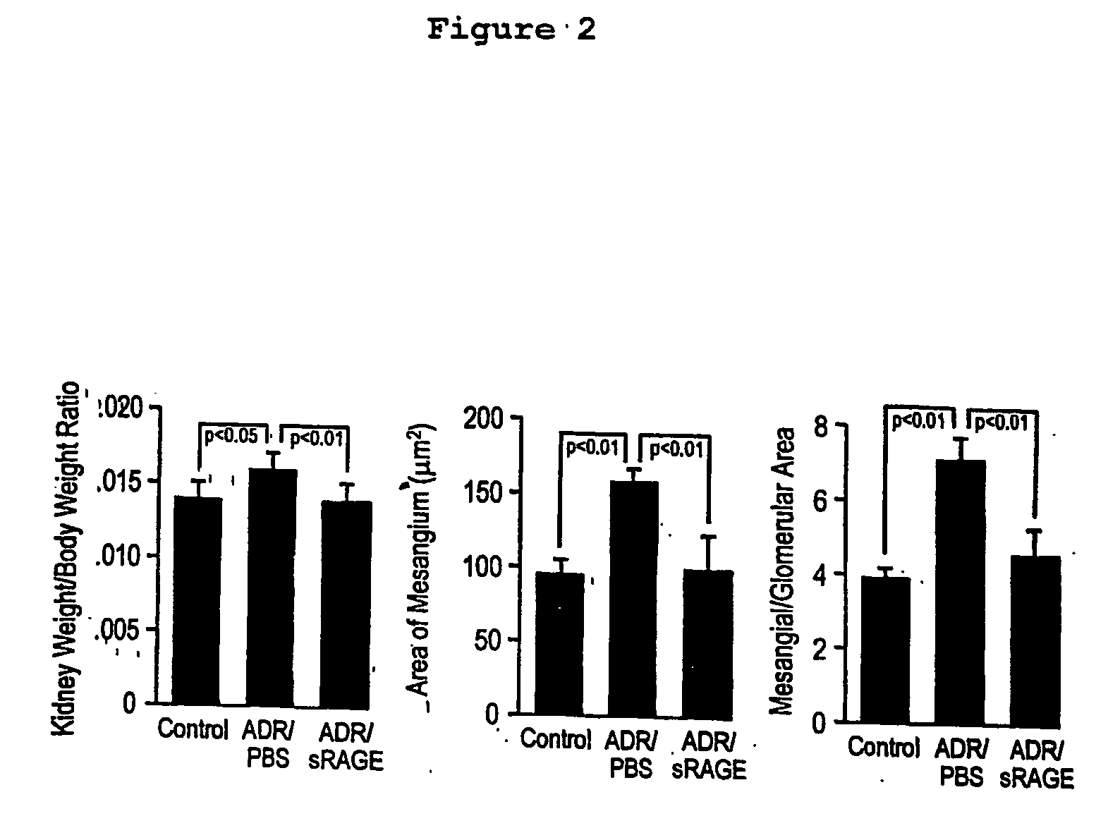 Rage-related methods and copositions for treating glomerular injury