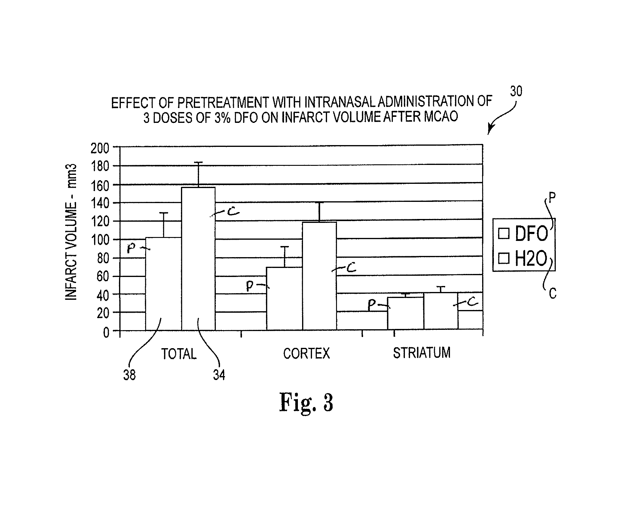 Method of treating stroke comprising administering metal chelators to the upper one-third of the nasal cavity