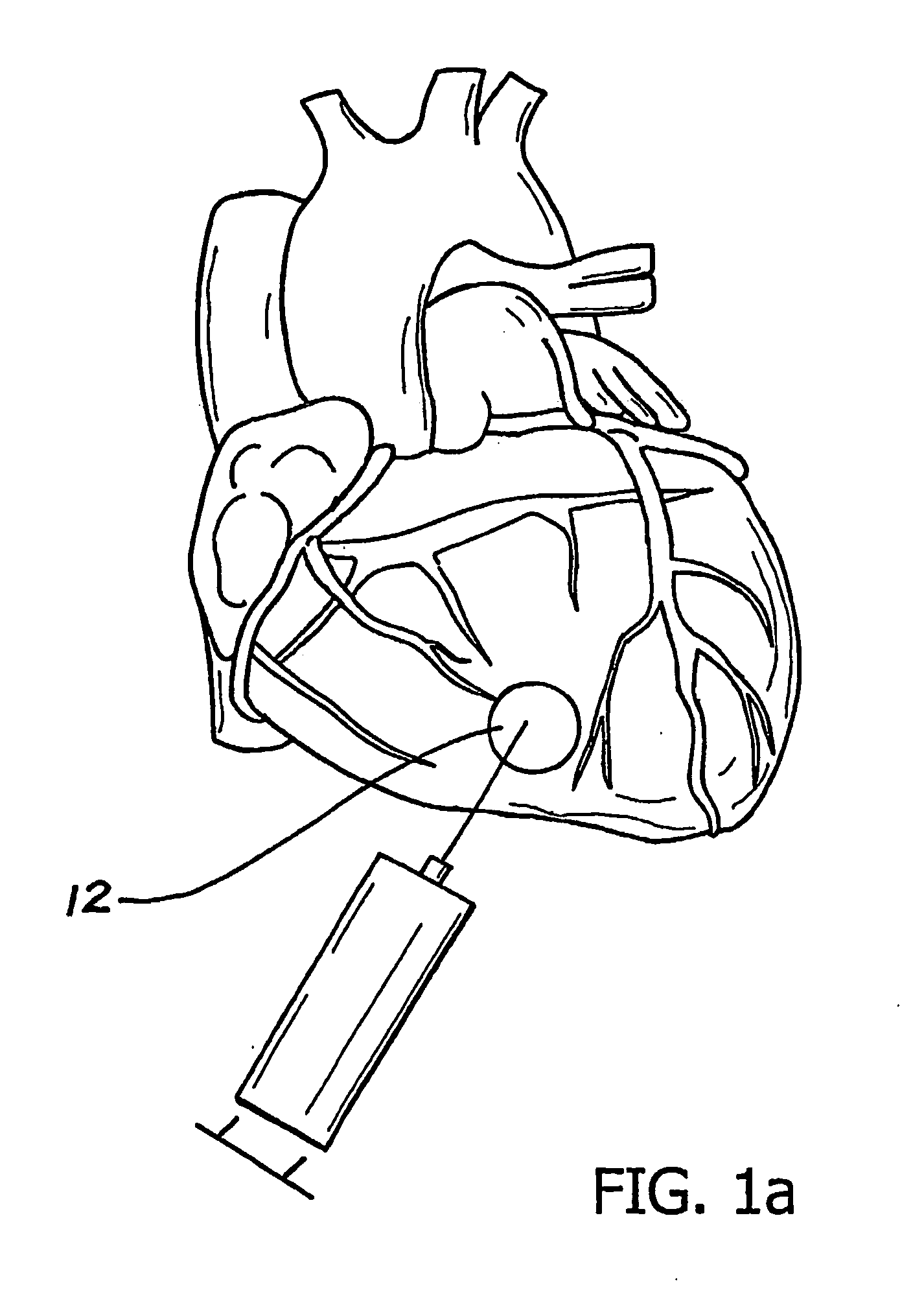 Method and apparatus for using an electromagnetic field in cellular transplantation