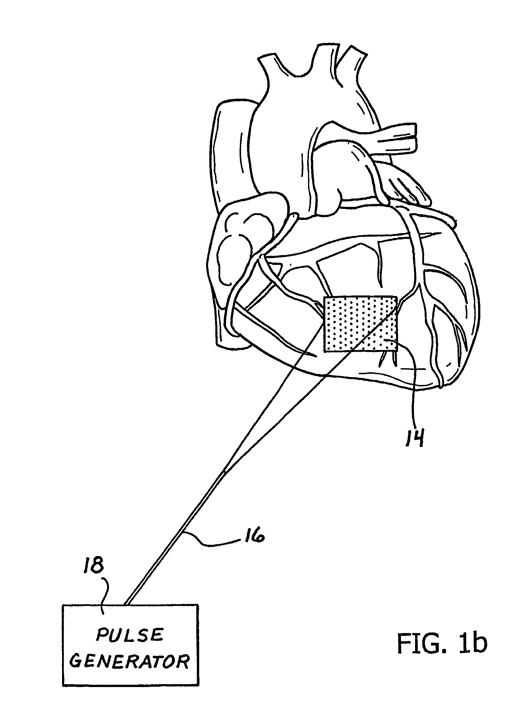 Method and apparatus for using an electromagnetic field in cellular transplantation