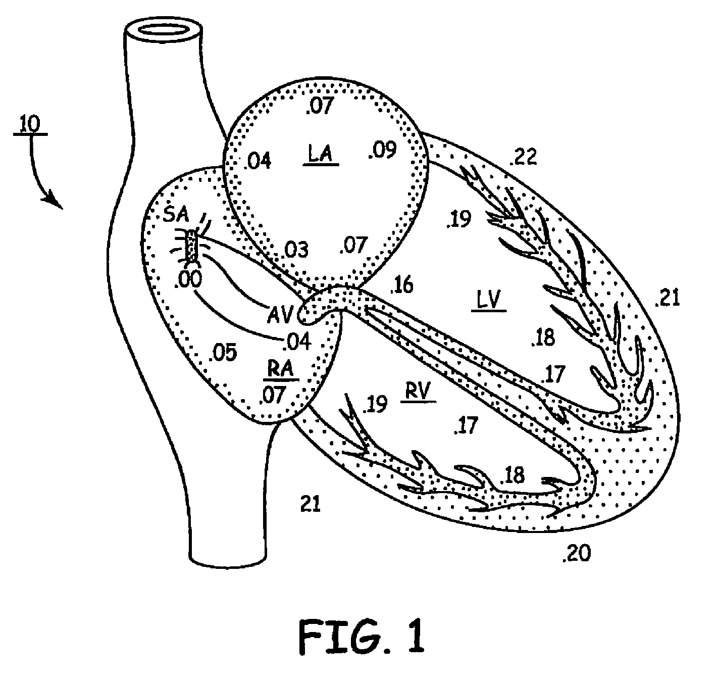 Method of continuous capture verification in cardiac resynchronization devices