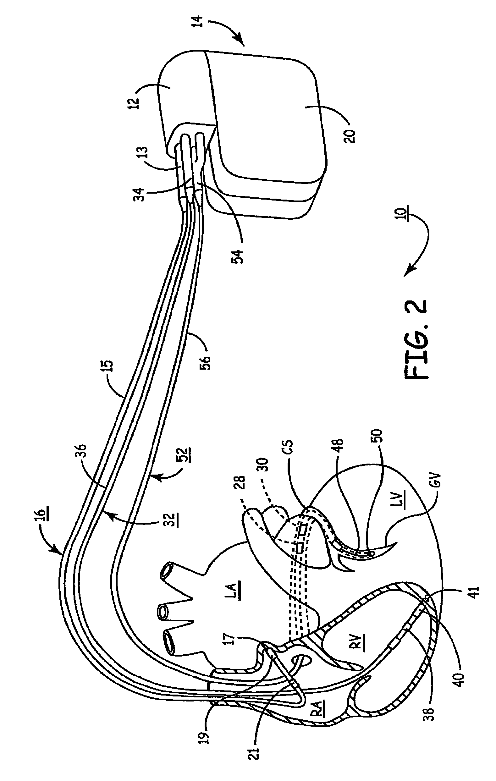 Method of continuous capture verification in cardiac resynchronization devices