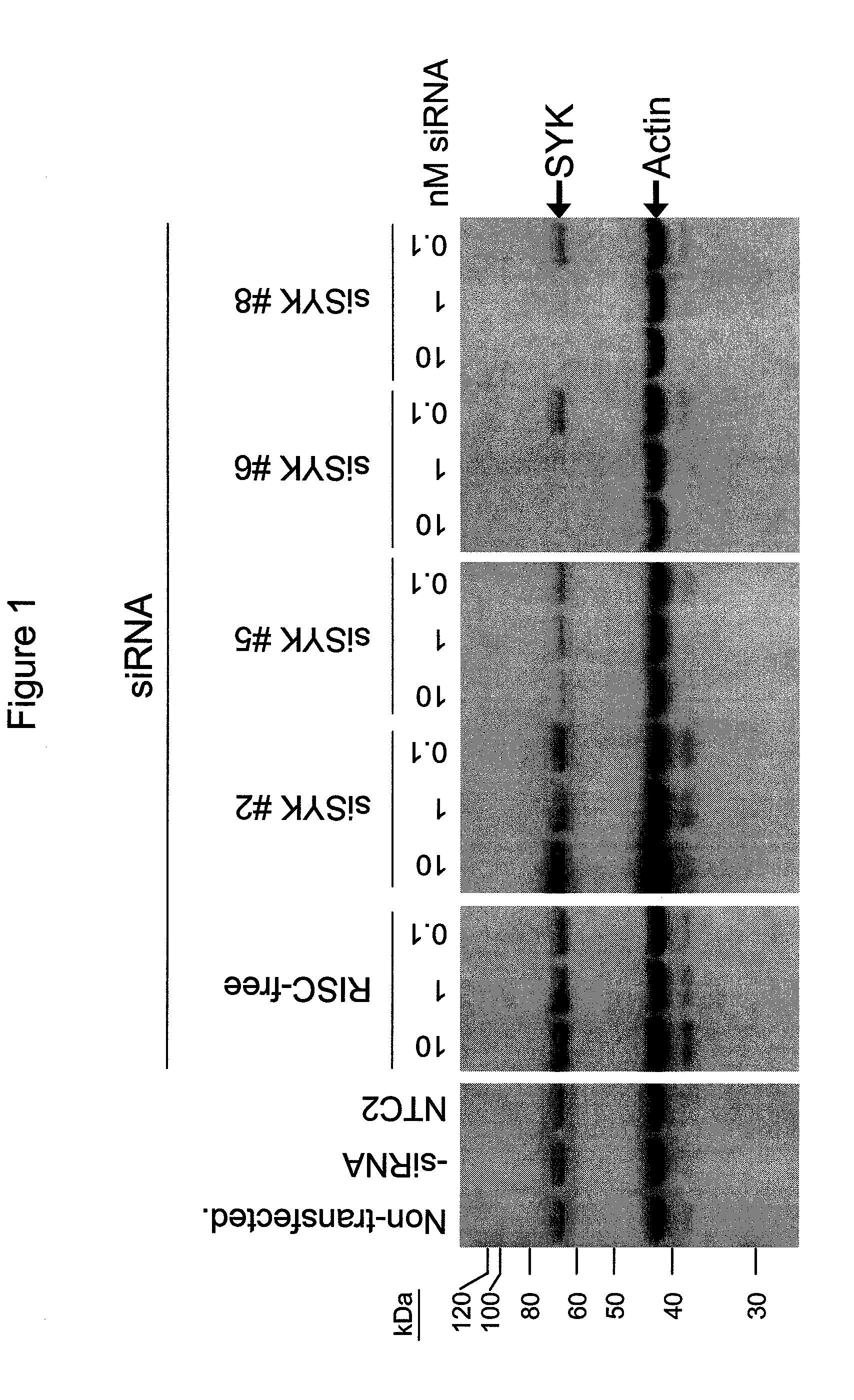 RNAi-mediated inhibition of spleen tyrosine kinase-related inflammatory conditions