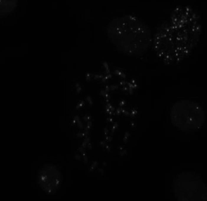 A Method of Using Digoxigenin-labeled Oligonucleotide Centromere Probes for In Situ Hybridization