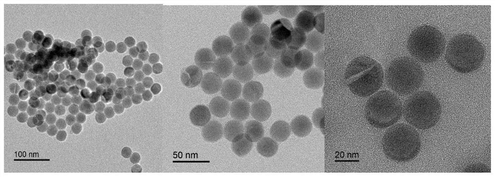 Energy resonance transfer technology based on upconversion fluorescence for detection of exosomes