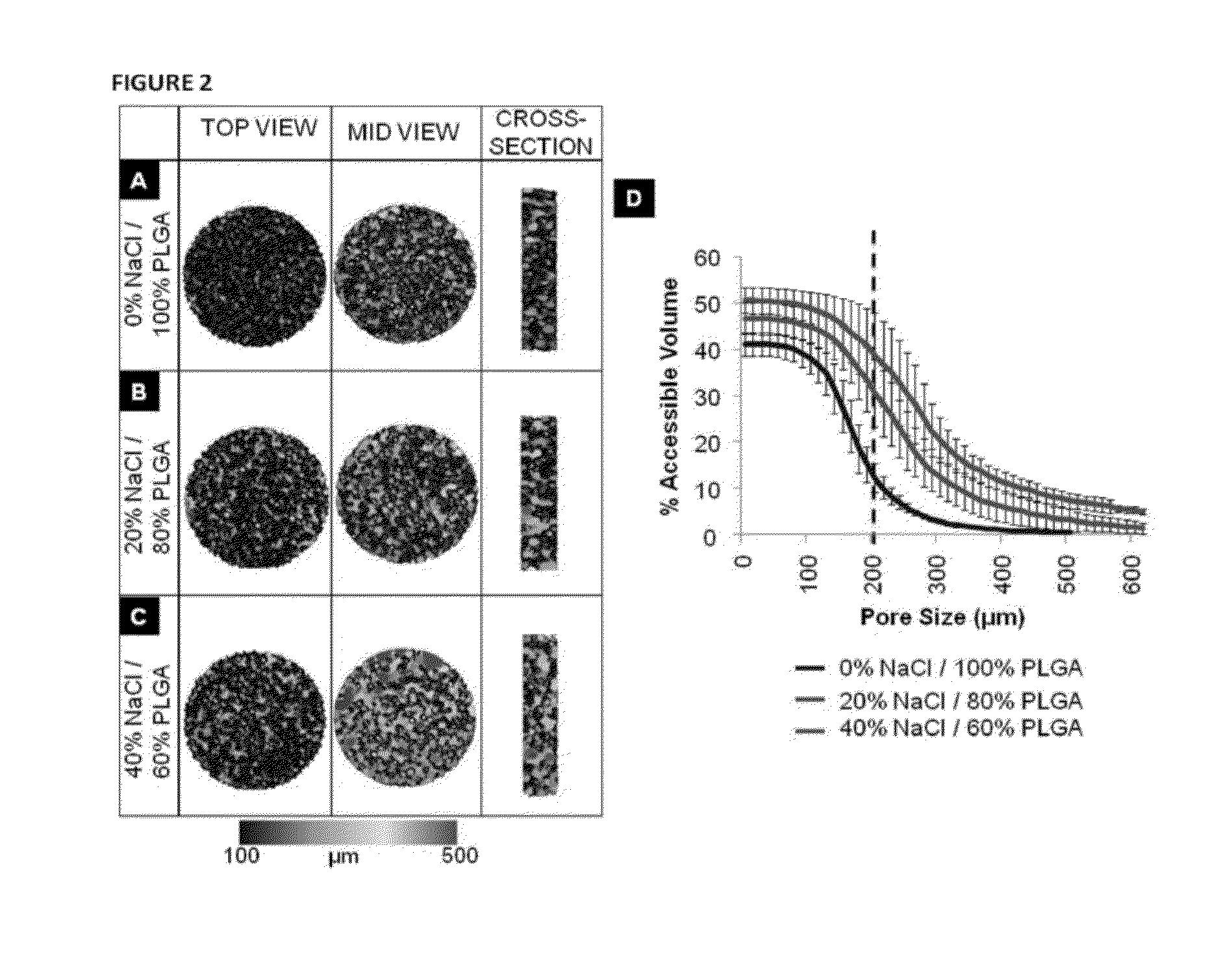 Gradient Porous Scaffolds