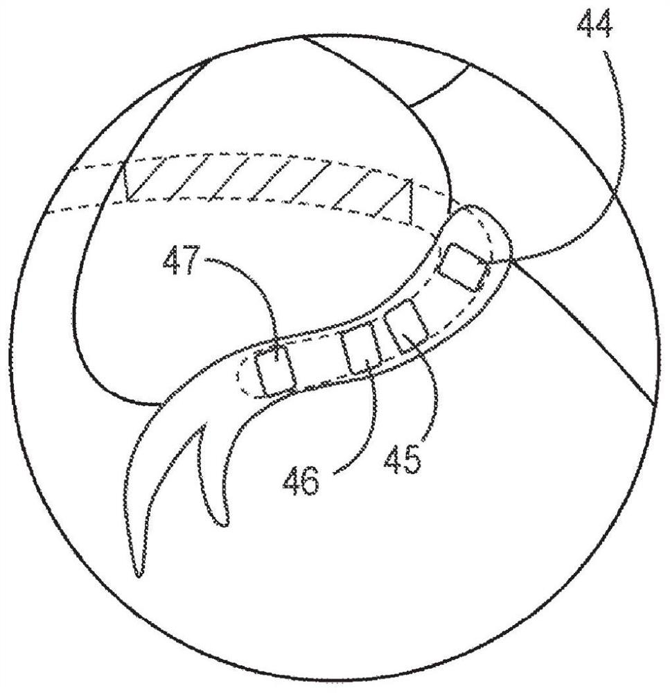 Non-invasive detection of phrenic nerve stimulation