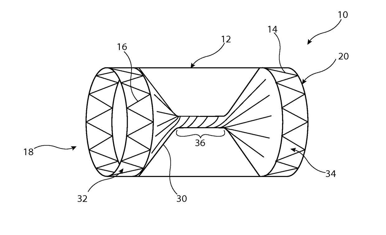 Implantable medical device with twisted element