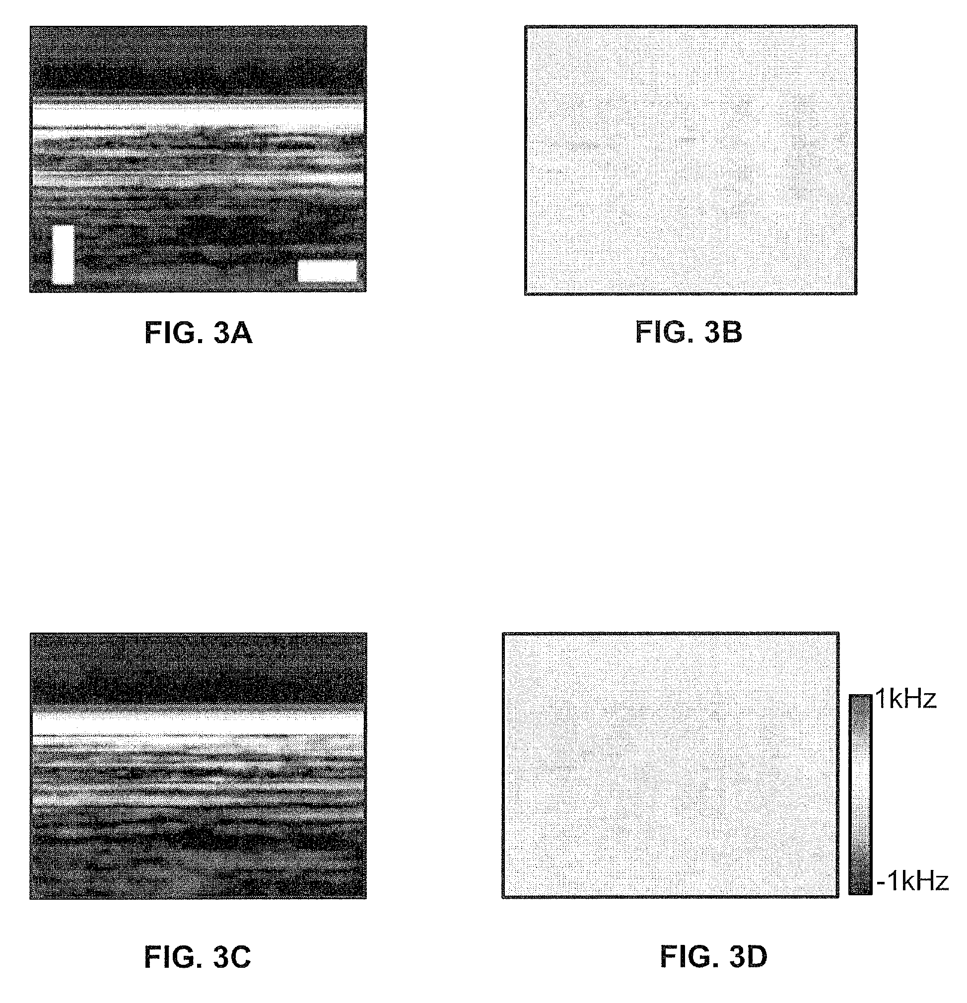 Hemoglobin contrast in magneto-motive optical doppler tomography, optical coherence tomography, and ultrasound imaging methods and apparatus