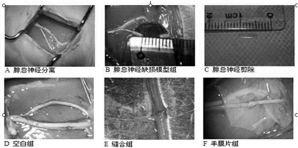 Preparation method and application of HAM (human amniotic membrane) neural tube