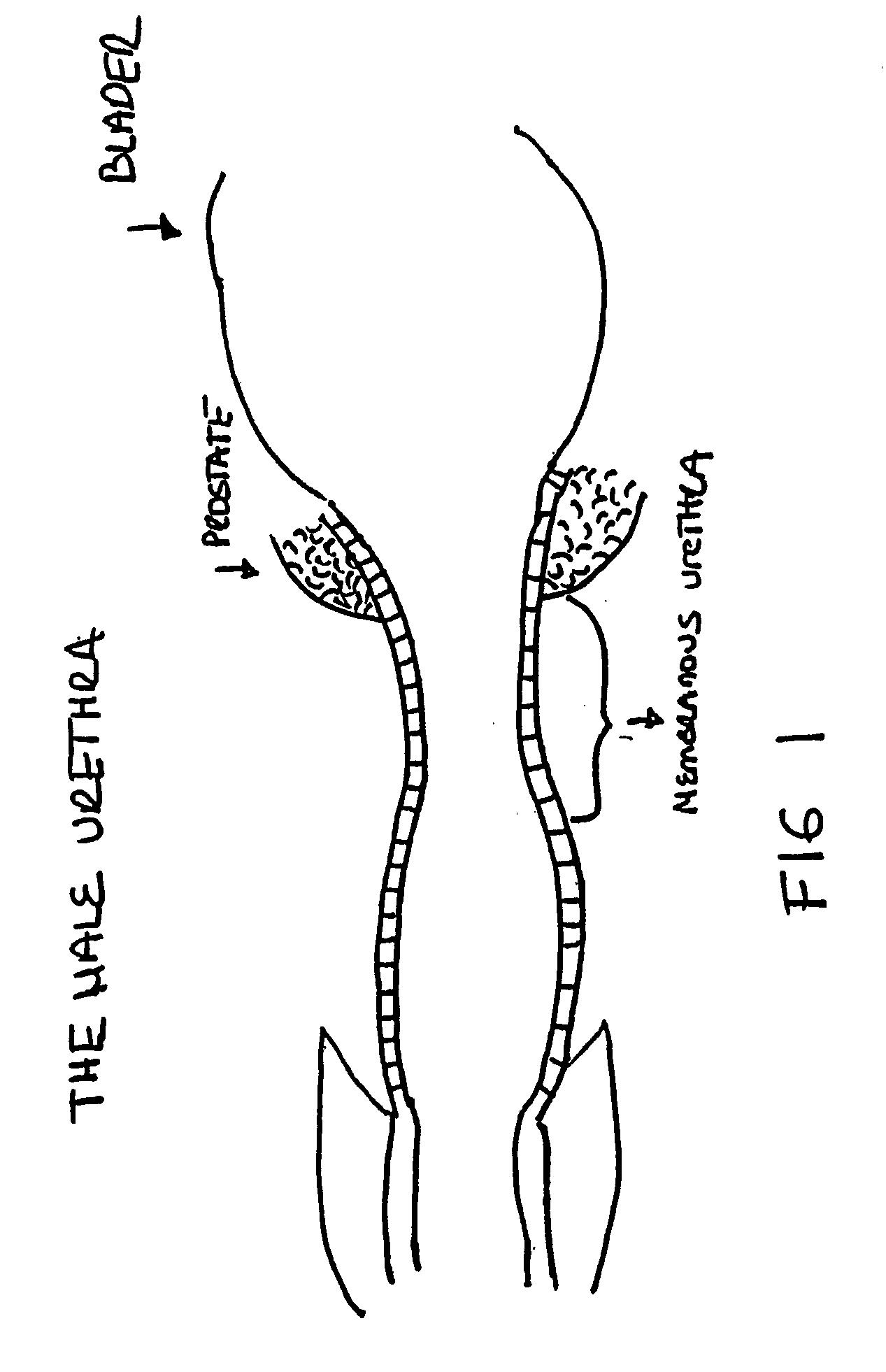 Augmentation and repair of spincter defects with cells including fibroblasts