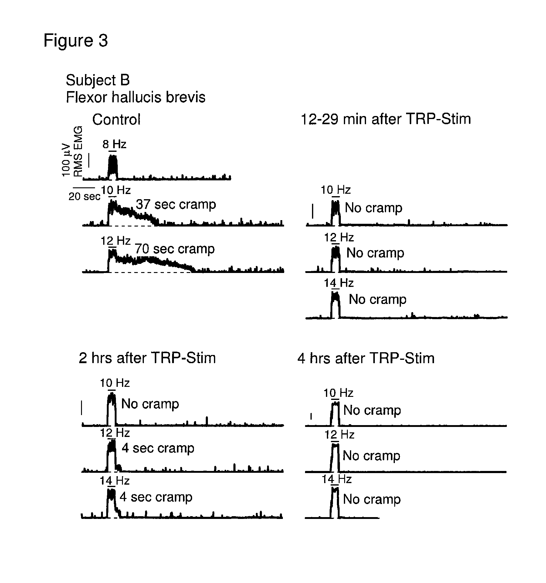 Methods and compositions for preventing and relieving muscle cramps and for recovery from neuromuscular irritability and fatigue following exercise