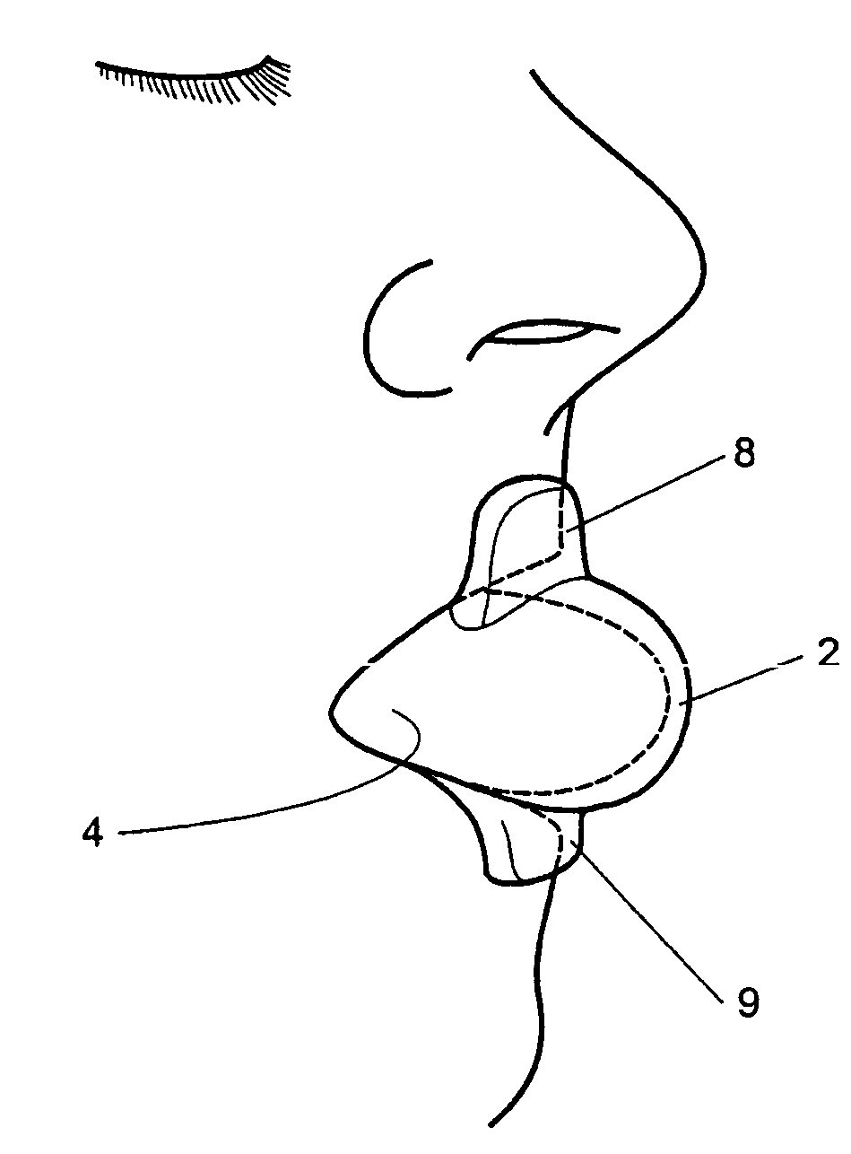 Tongue stabilizing device