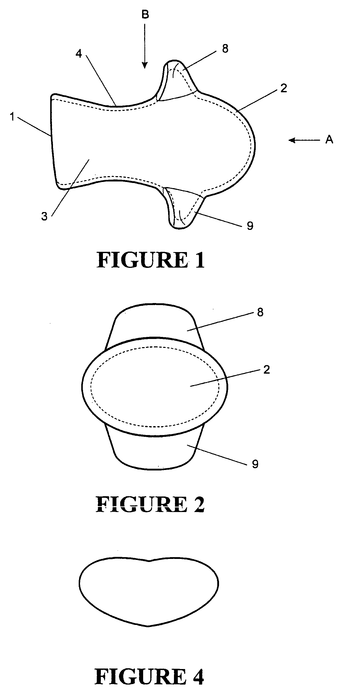 Tongue stabilizing device