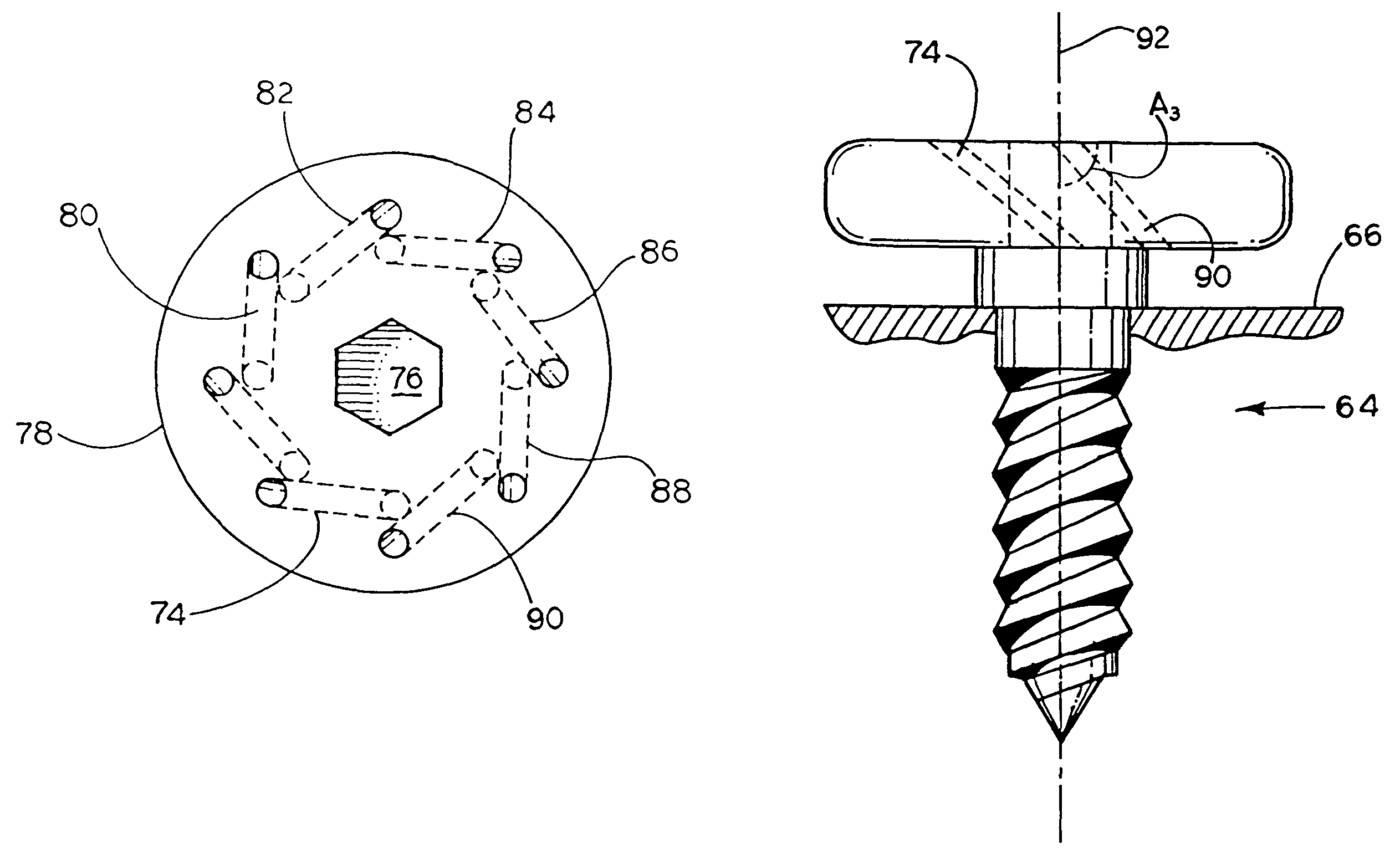 Soft tissue securing anchor