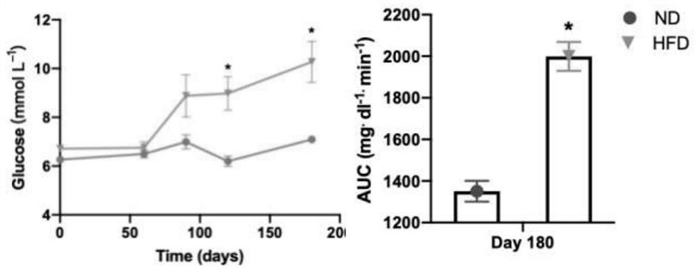 High-sugar diet induced early-stage dry age-related macular degeneration pigment rabbit model