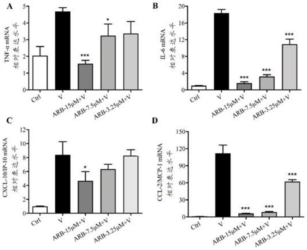 Application of arbidol in preparation of drug for prevention or treatment of diseases caused by SARS-CoV-2 virus