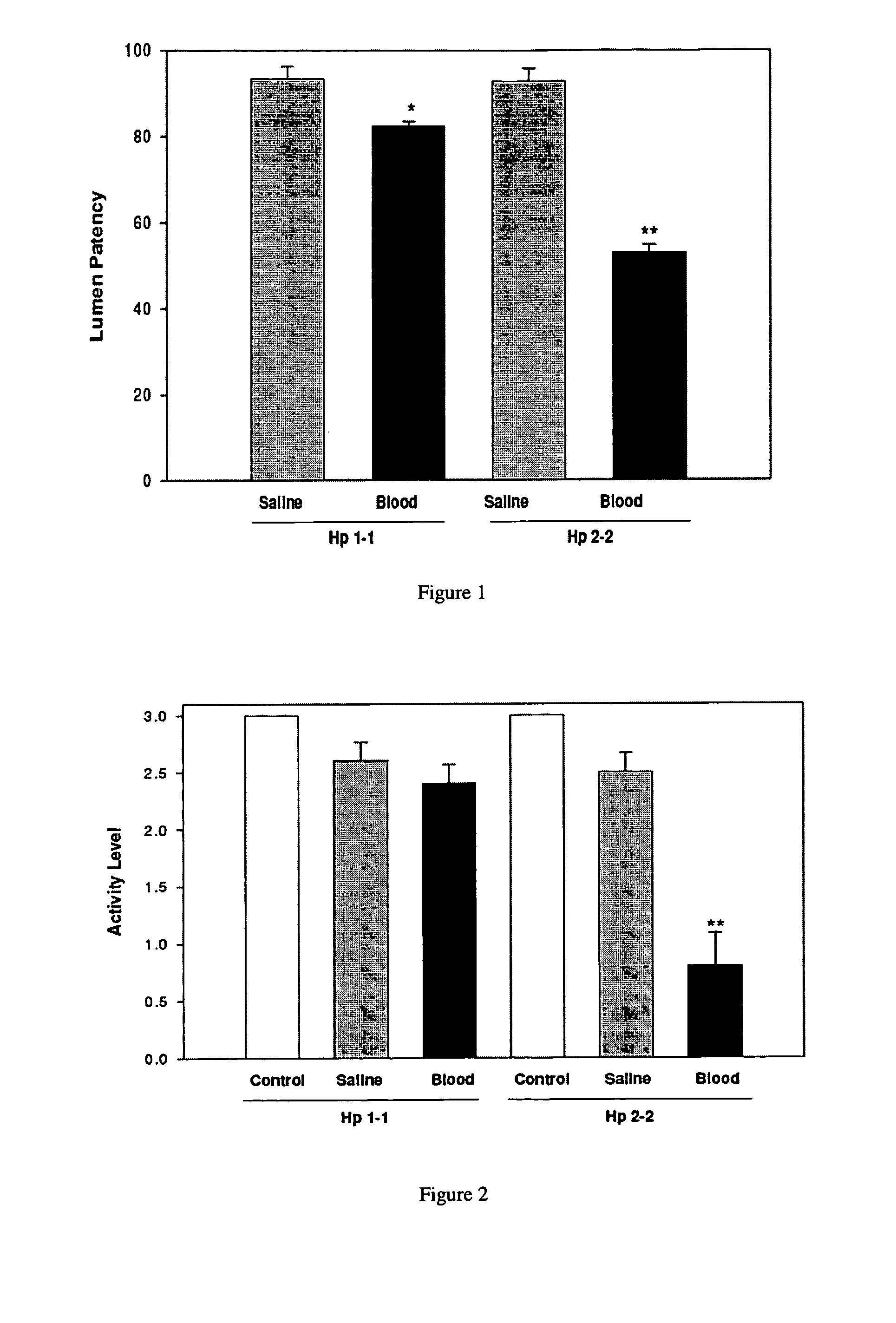 Haptoglobin genotyping for prognosis and treatment of chronic vasospasm following subarachnoid hemorrhage (SAH)