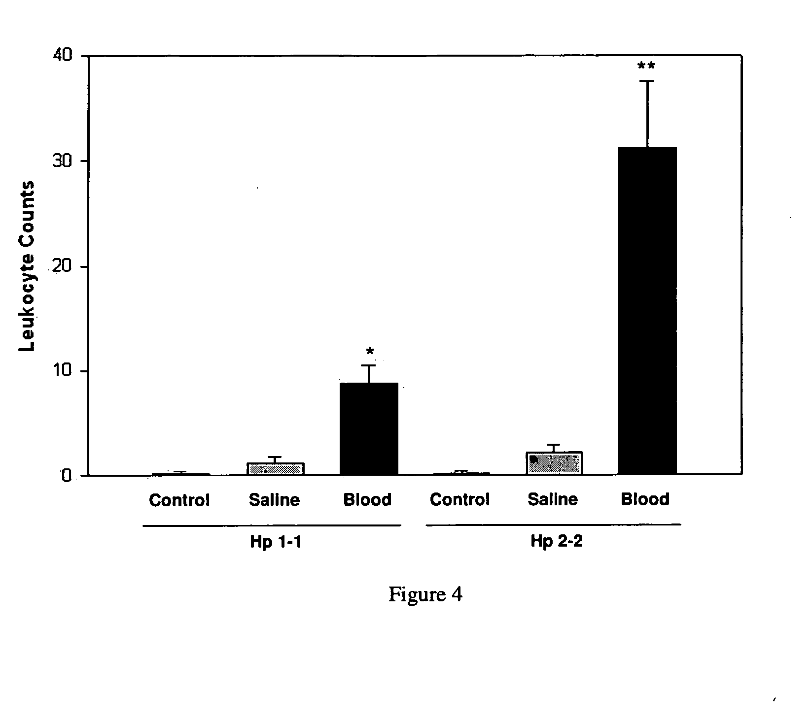 Haptoglobin genotyping for prognosis and treatment of chronic vasospasm following subarachnoid hemorrhage (SAH)