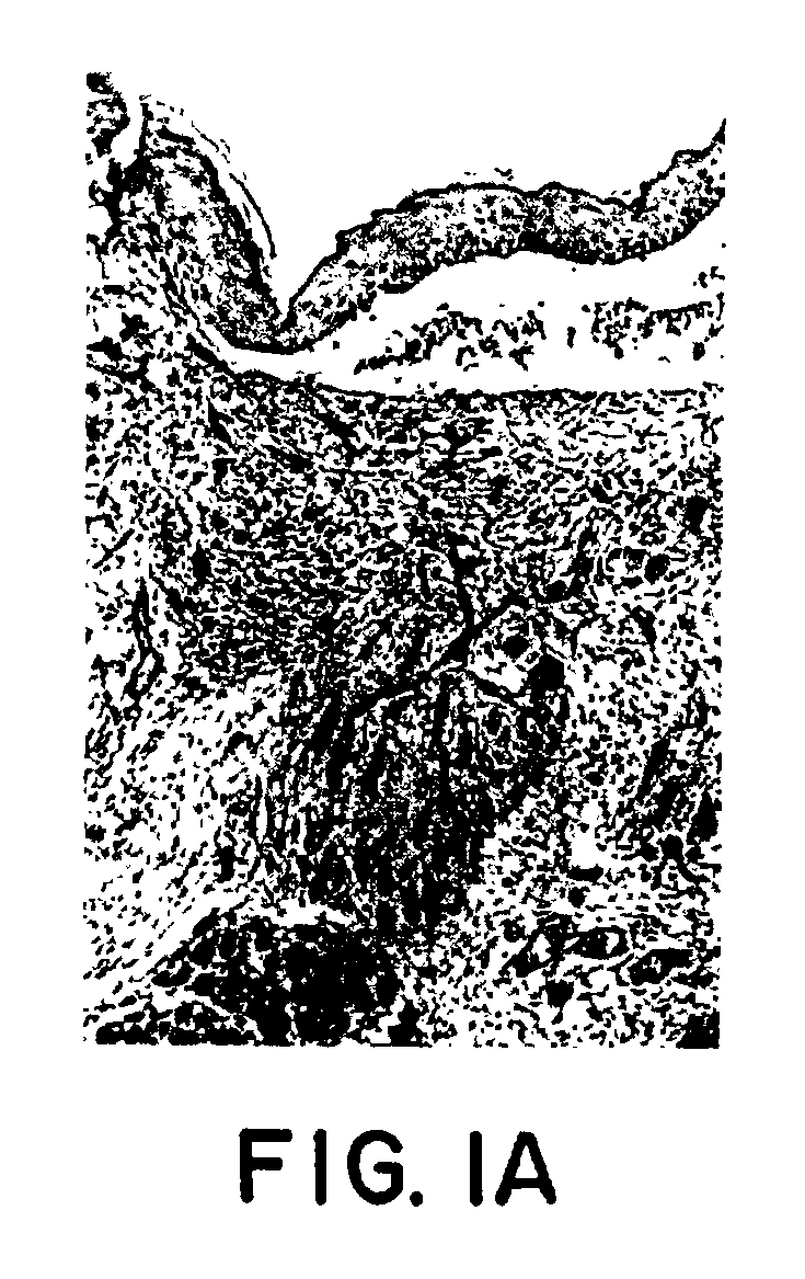 Contrast enhancement agent for magnetic resonance imaging