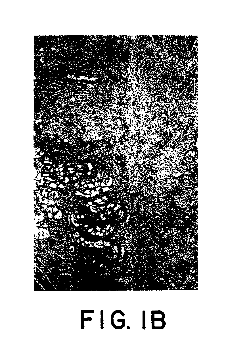 Contrast enhancement agent for magnetic resonance imaging