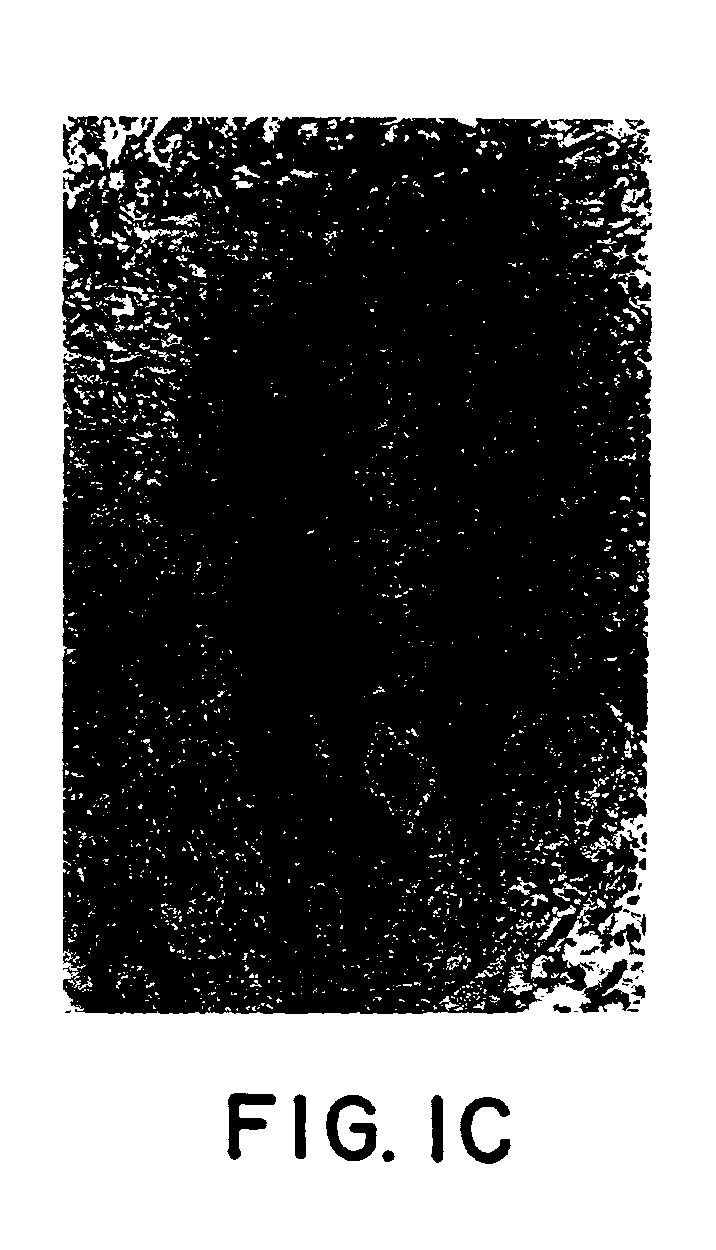 Contrast enhancement agent for magnetic resonance imaging