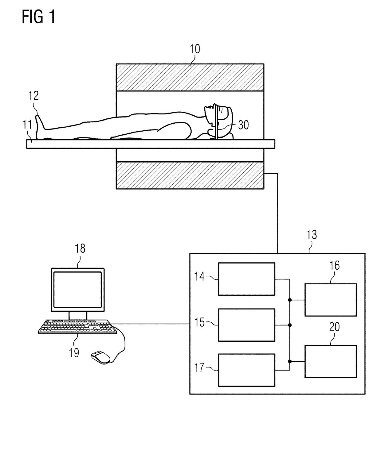 Magnetic resonance apparatus and method for vascular imaging