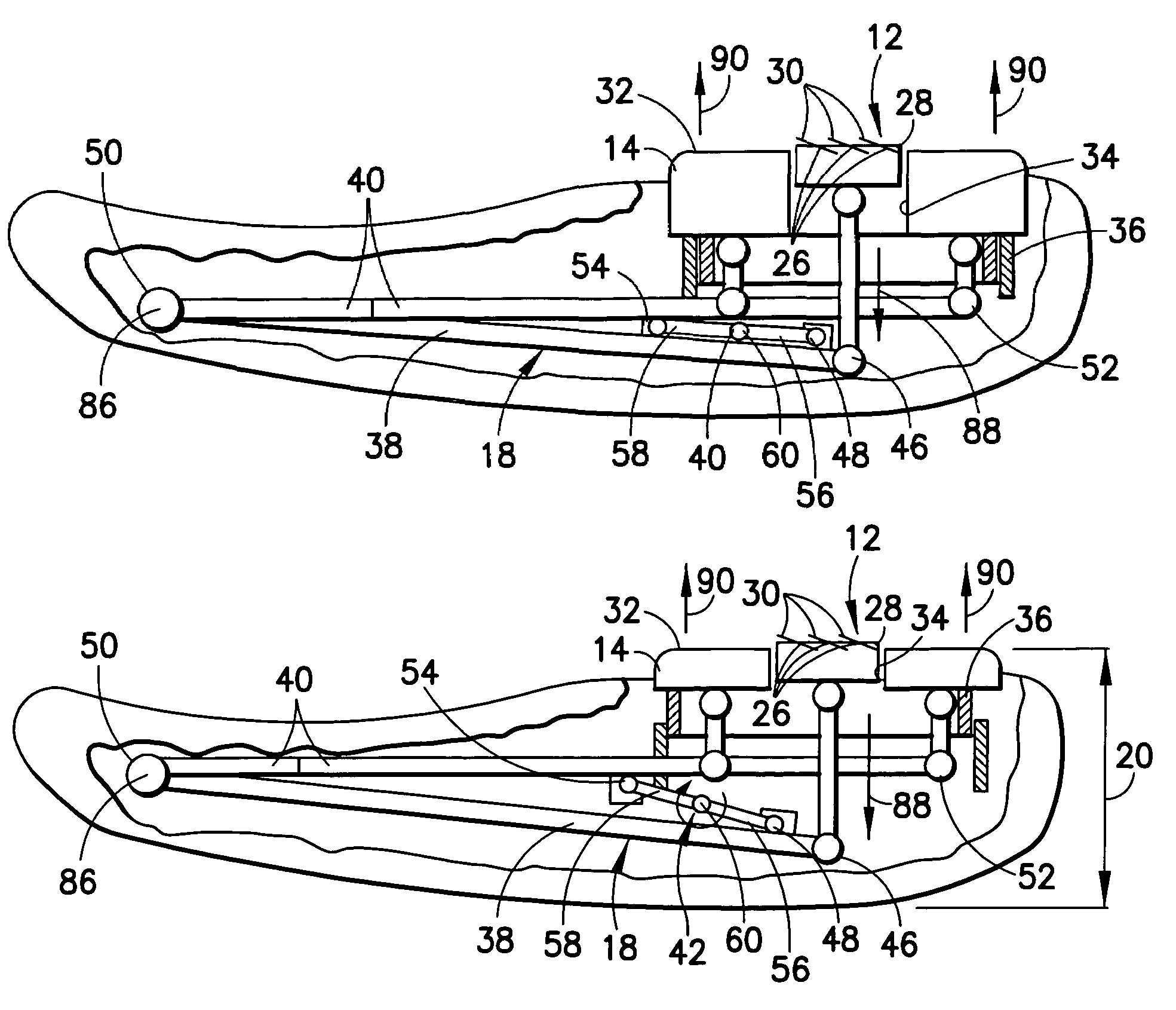 Razor assembly