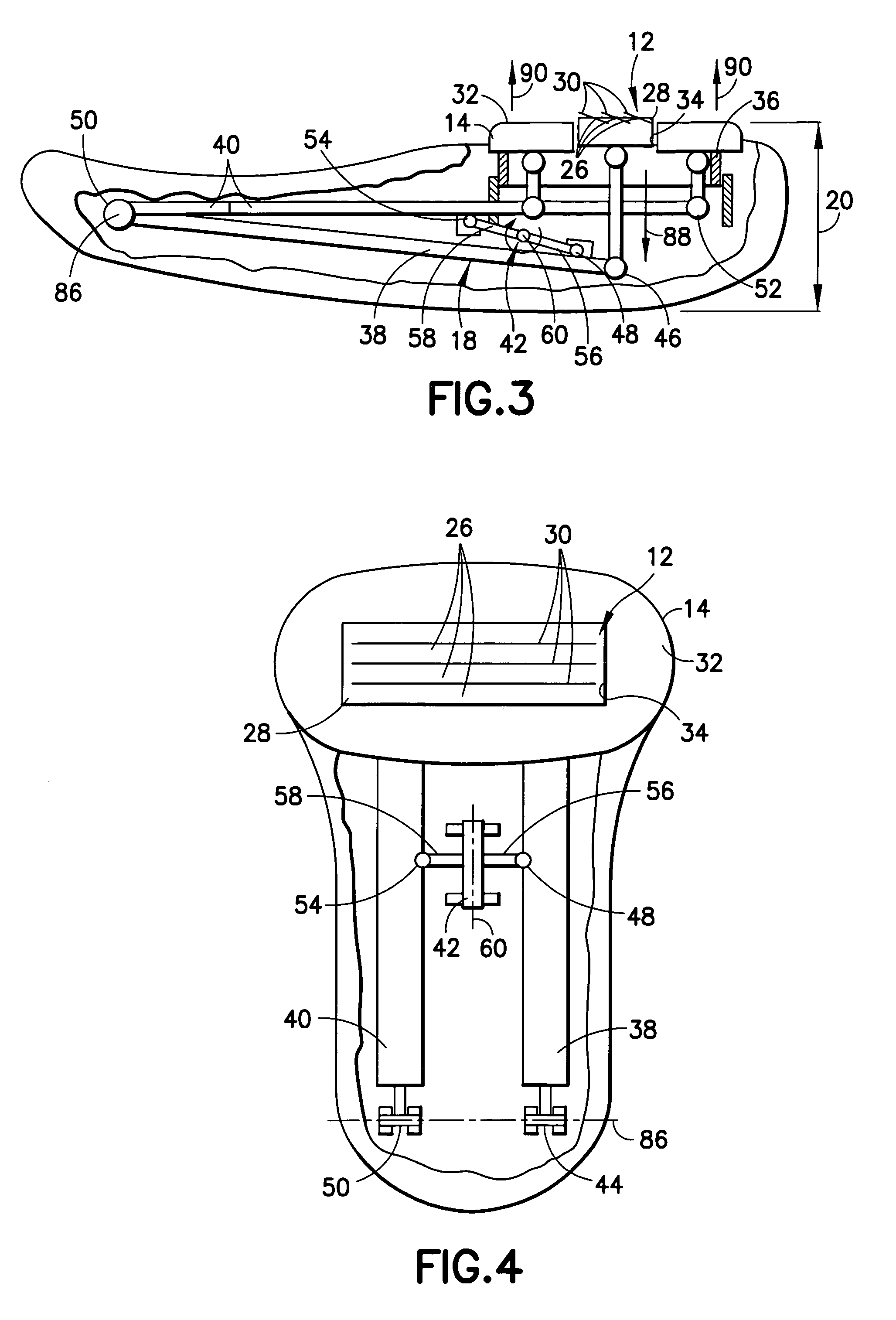 Razor assembly