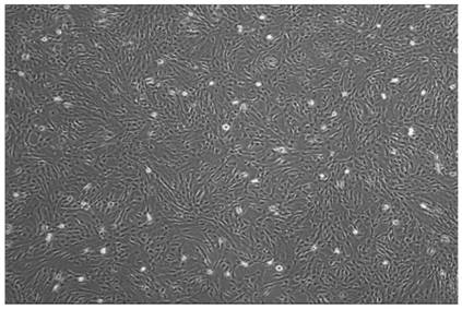 Method for extracting amniotic stem cells