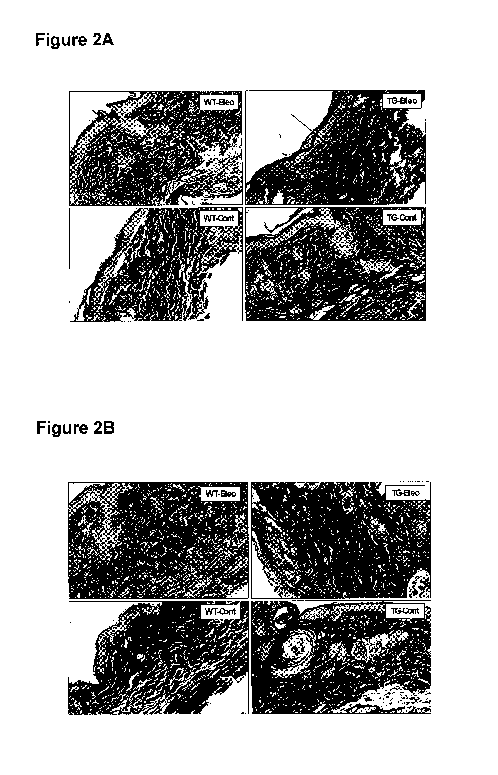 Cd109 polypeptides and uses thereof for the treatment of skin cells