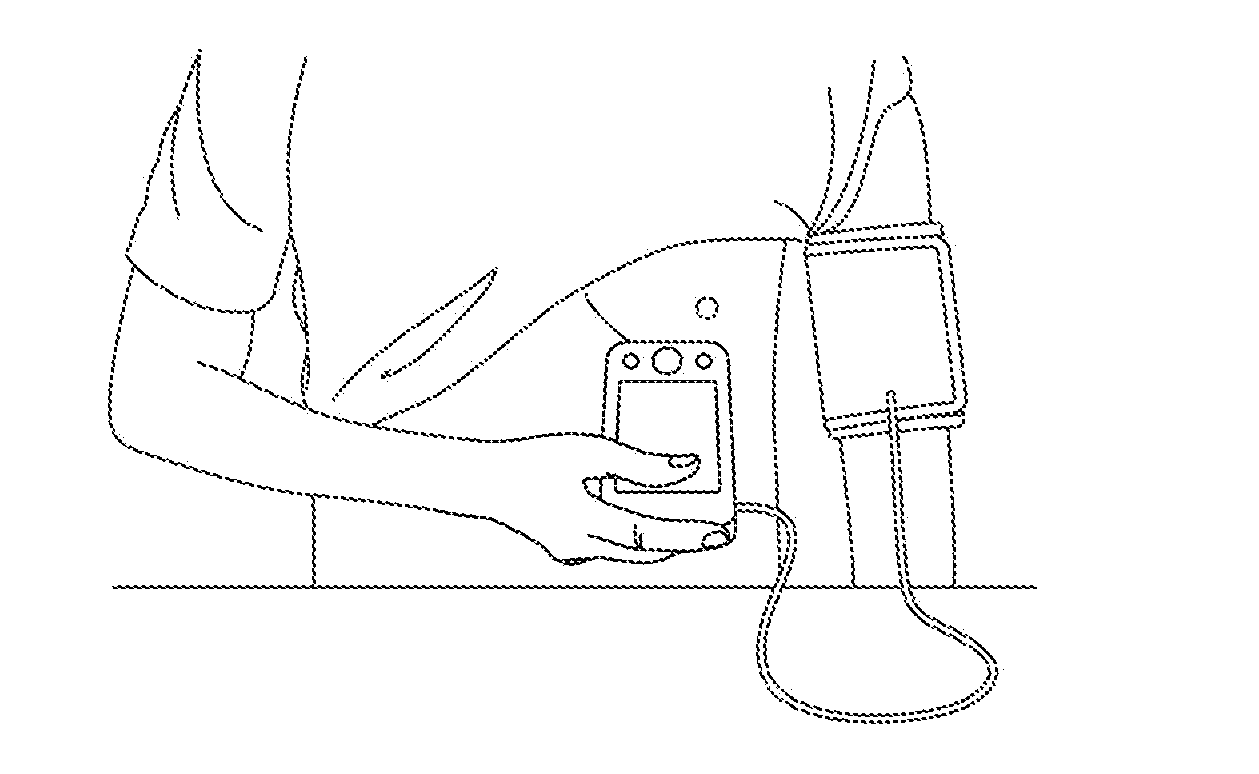 Cardiovascular monitoring device