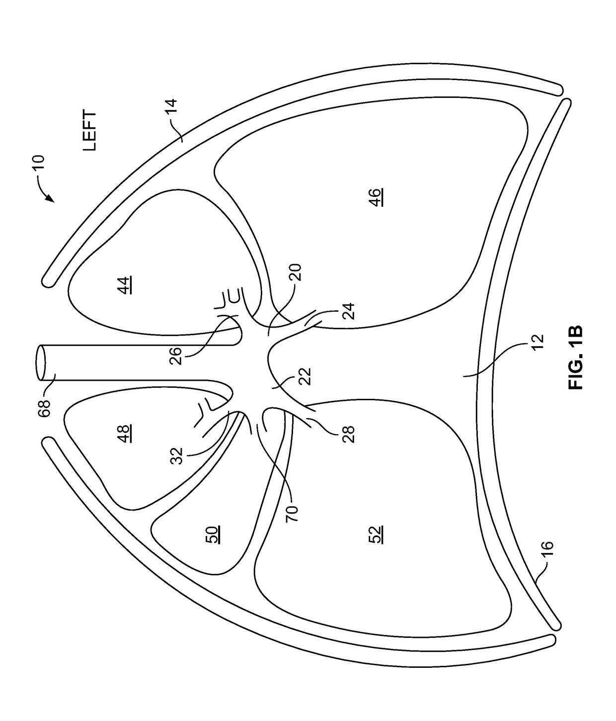 Screening method for a target nerve to ablate for the treatment of inflammatory lung disease