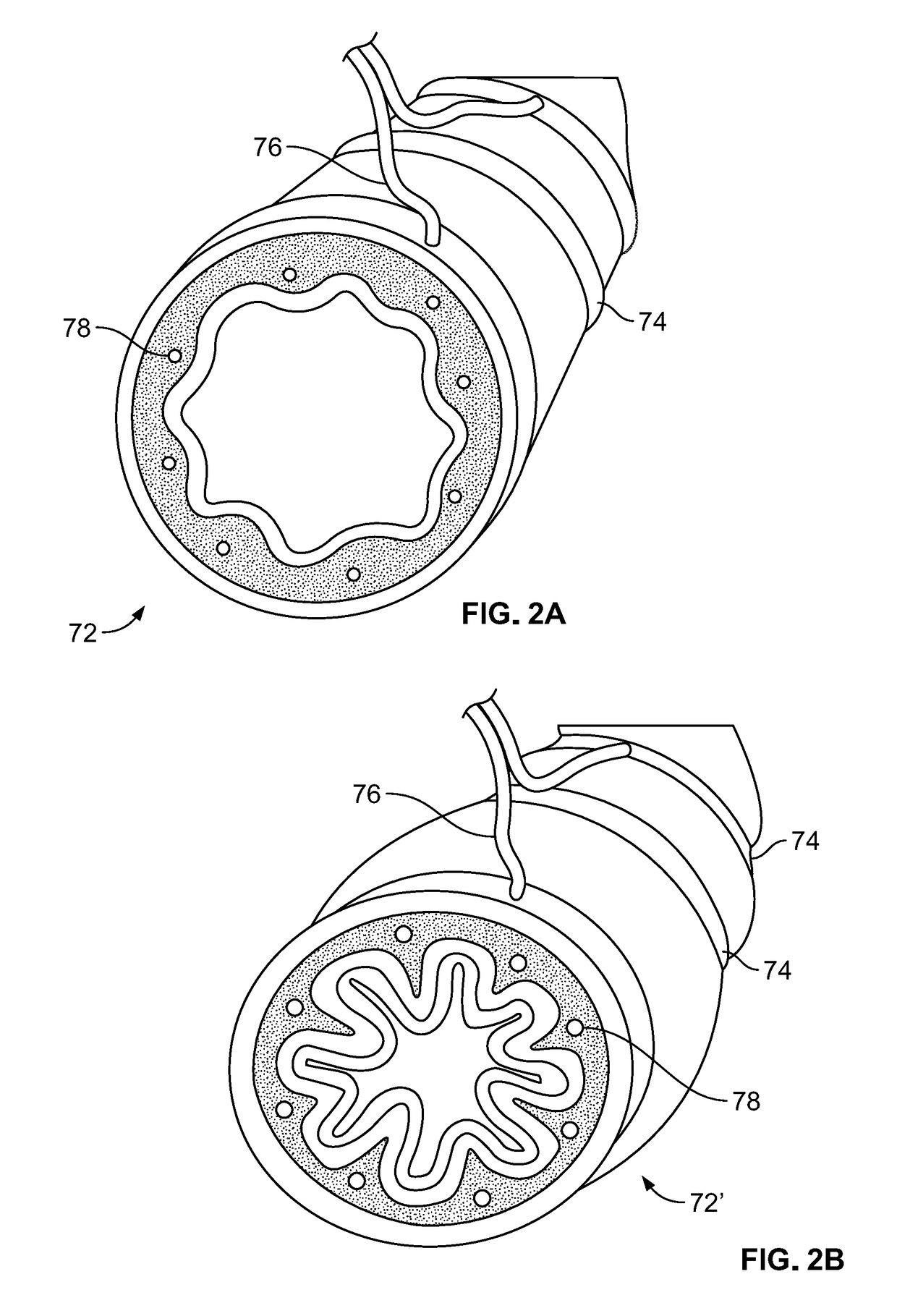 Screening method for a target nerve to ablate for the treatment of inflammatory lung disease