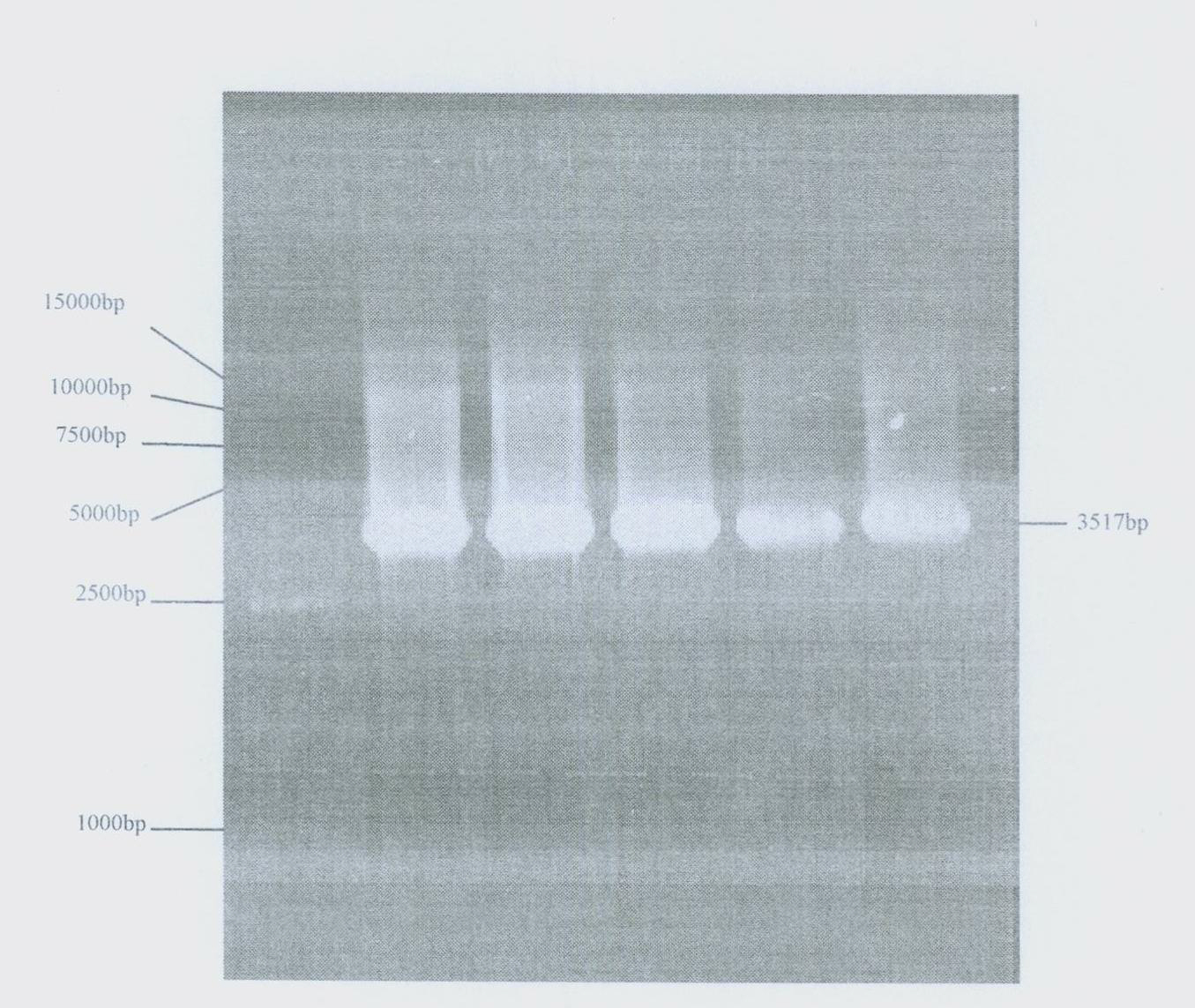 Plasmid type adenovirus vector pAd-NRIP1 and construction method thereof