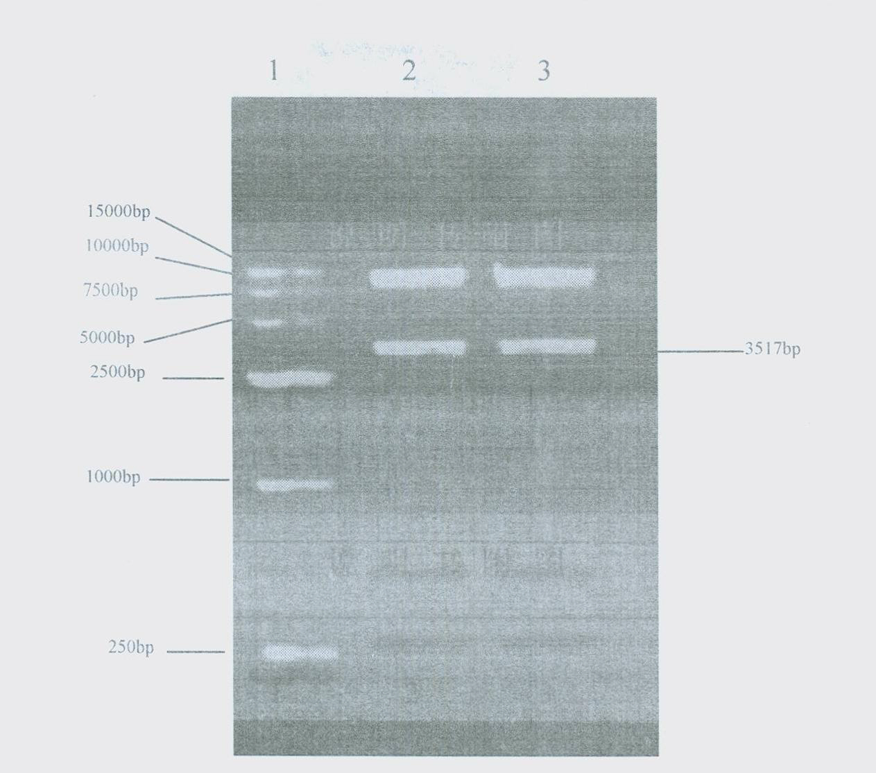 Plasmid type adenovirus vector pAd-NRIP1 and construction method thereof