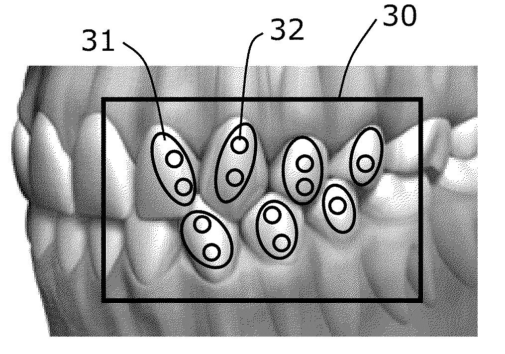 Methods And Composition For Tracking Jaw Motion