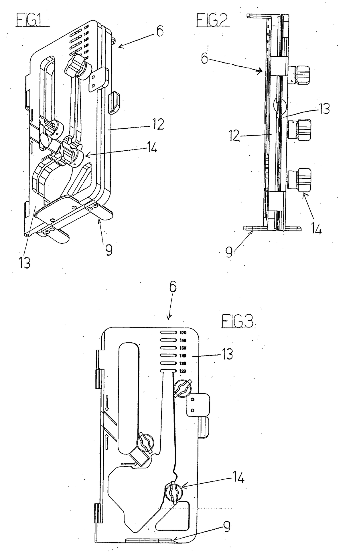 Mould for realizing a temporary prosthesis of hip or shoulder, and method thereof